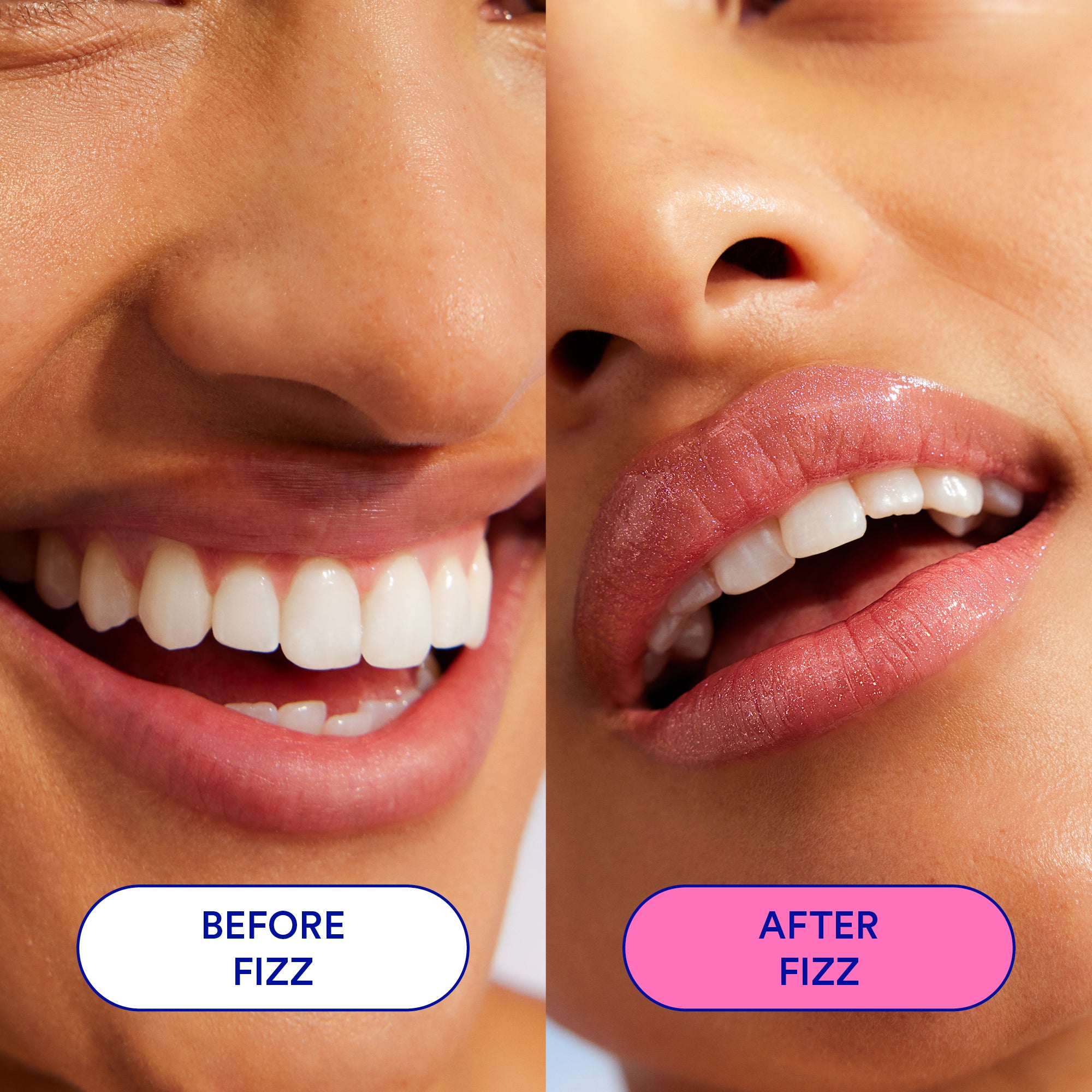 Fizz Sheen Screen™ SPF 50 Hydrating Lip Balm